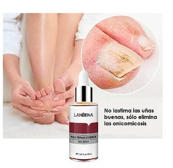 LANBENA Esencia de Reparación de Uñas