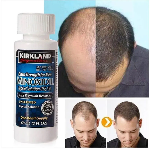 Minoxidil Líquido Para Barba y Cabello
