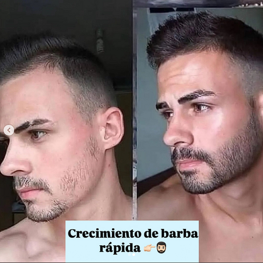 Minoxidil Líquido Para Barba y Cabello